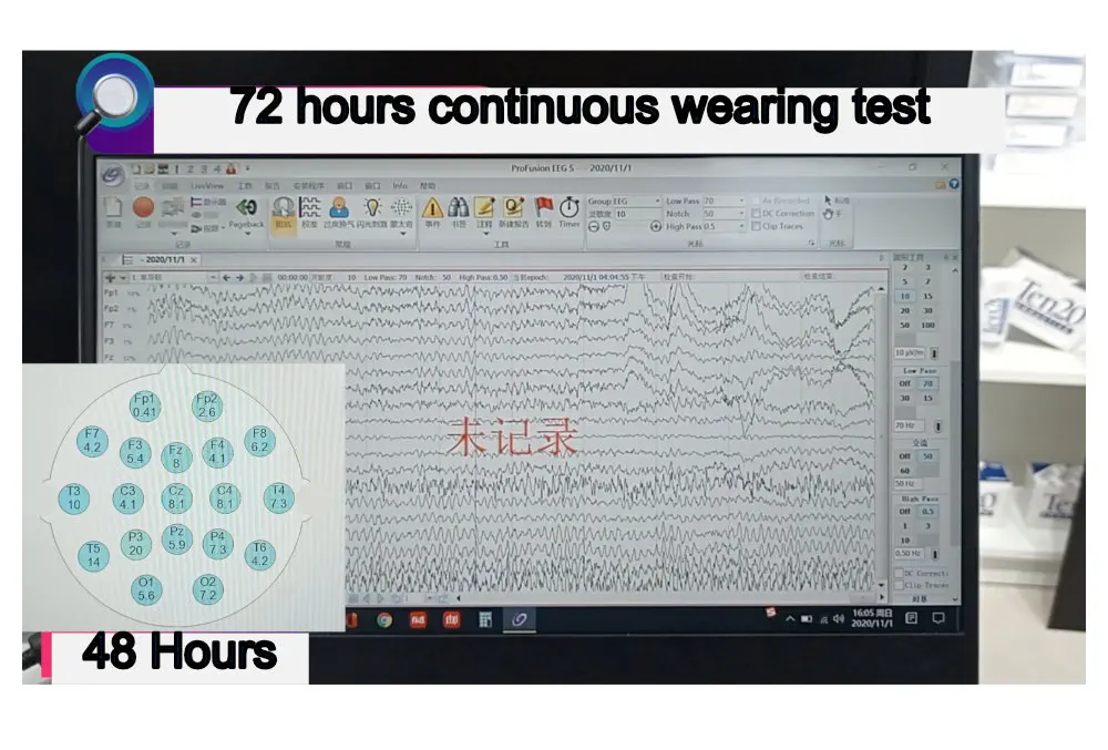 EEG Cap for Cup Electrode | Tenocom