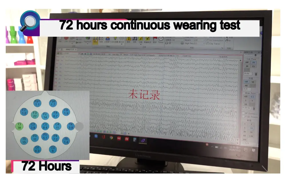 EEG Cap for Cup Electrode | Tenocom