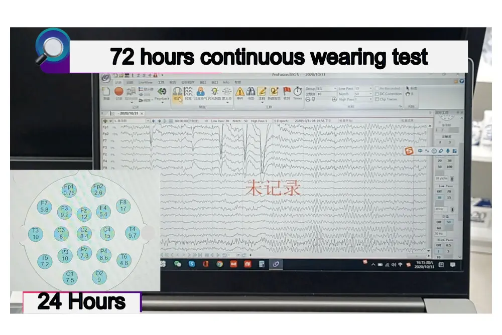 EEG Cap for Cup Electrode | Tenocom
