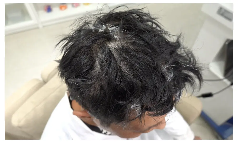 EEG Cap for Cup Electrode | Tenocom